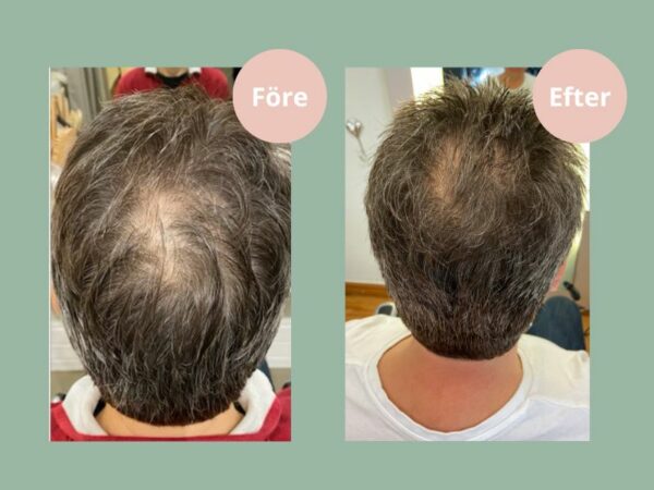 Hjärtligt Hair Growth Balsam - Bild 3