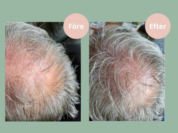 Hjärtligt Hair Growth Balsam - Bild 2