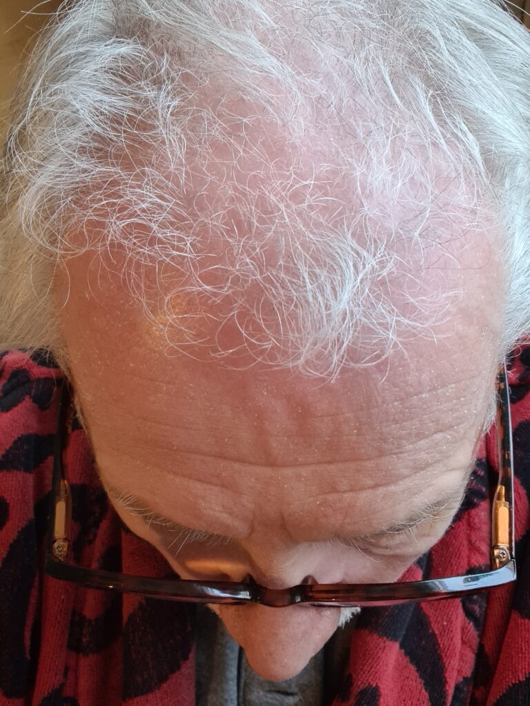 Image #1 from Anonym