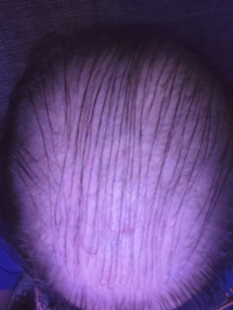 Image #1 from Anonym